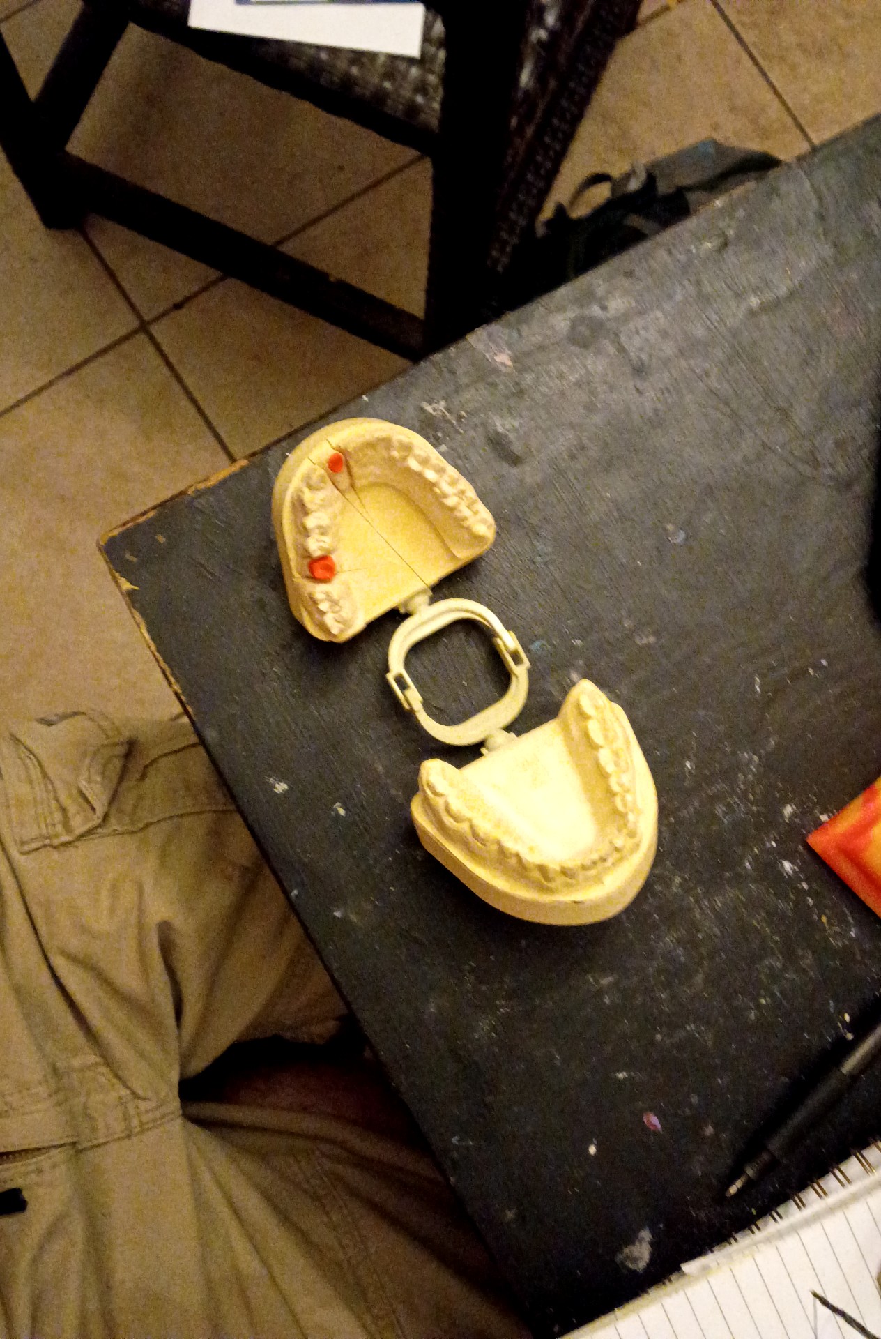 Yellow dental plaster model of human teeth with a plastic hinge mechanism and red restorative markings. - view 1